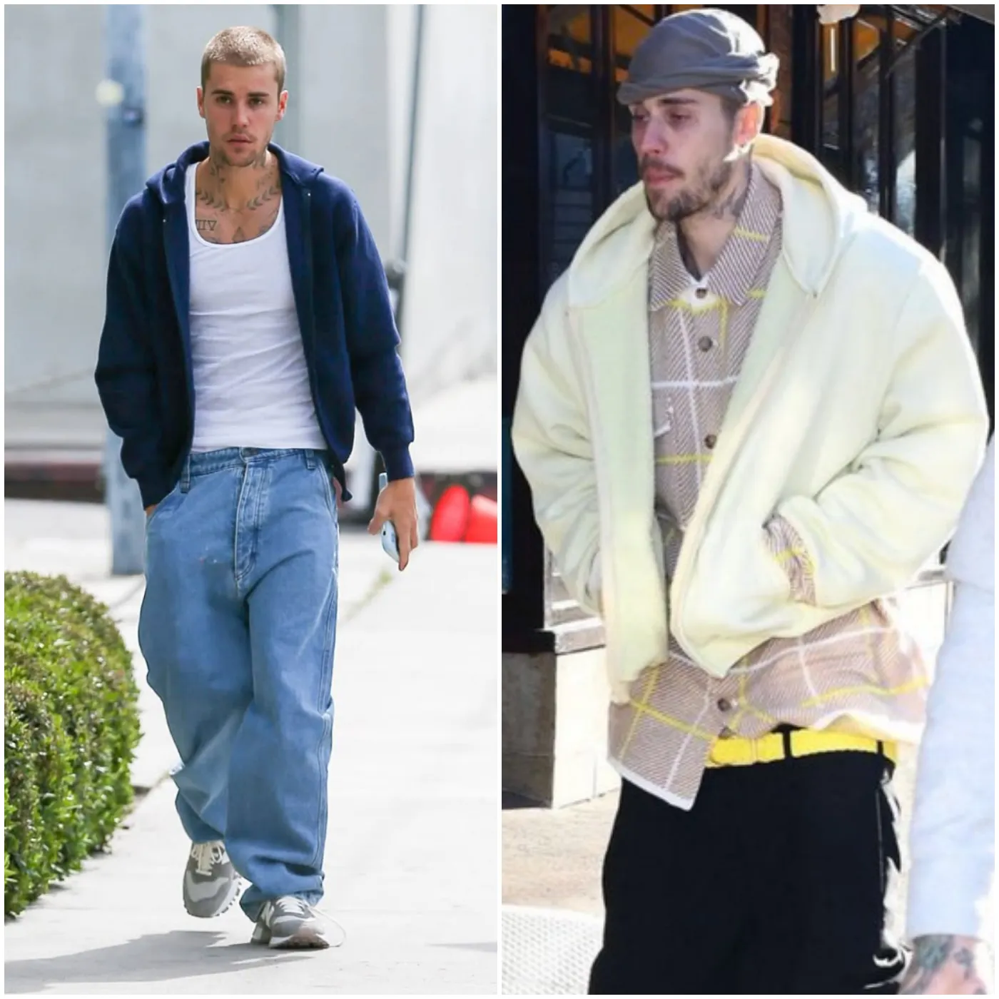 These shocking ‘Before and After’ Pictures of Justin Bieber Amid Divorce Rumors Have Fans Worried and Wondering: ‘What Ever Became of Him?’