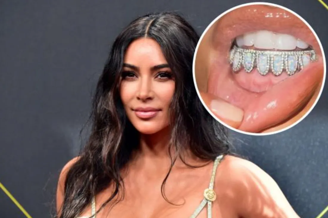 Kim Kardashian Flaunts Diamond-Encrusted Grillz – A Dazzling Trend in Celebrity Fashion