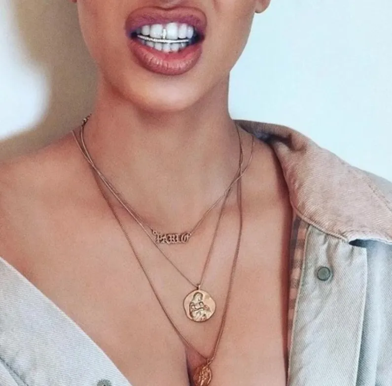 Kim Kardashian Flaunts Diamond-Encrusted Grillz – A Dazzling Trend in Celebrity Fashion