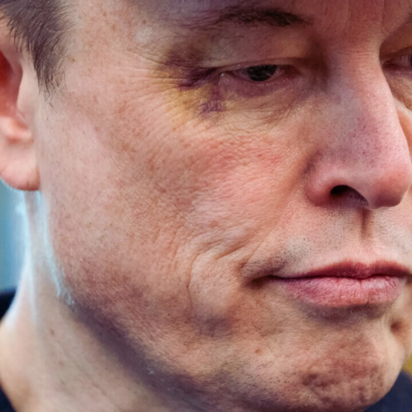 Elon Musk’s Black Eye Mystery Sparks Wild Speculation