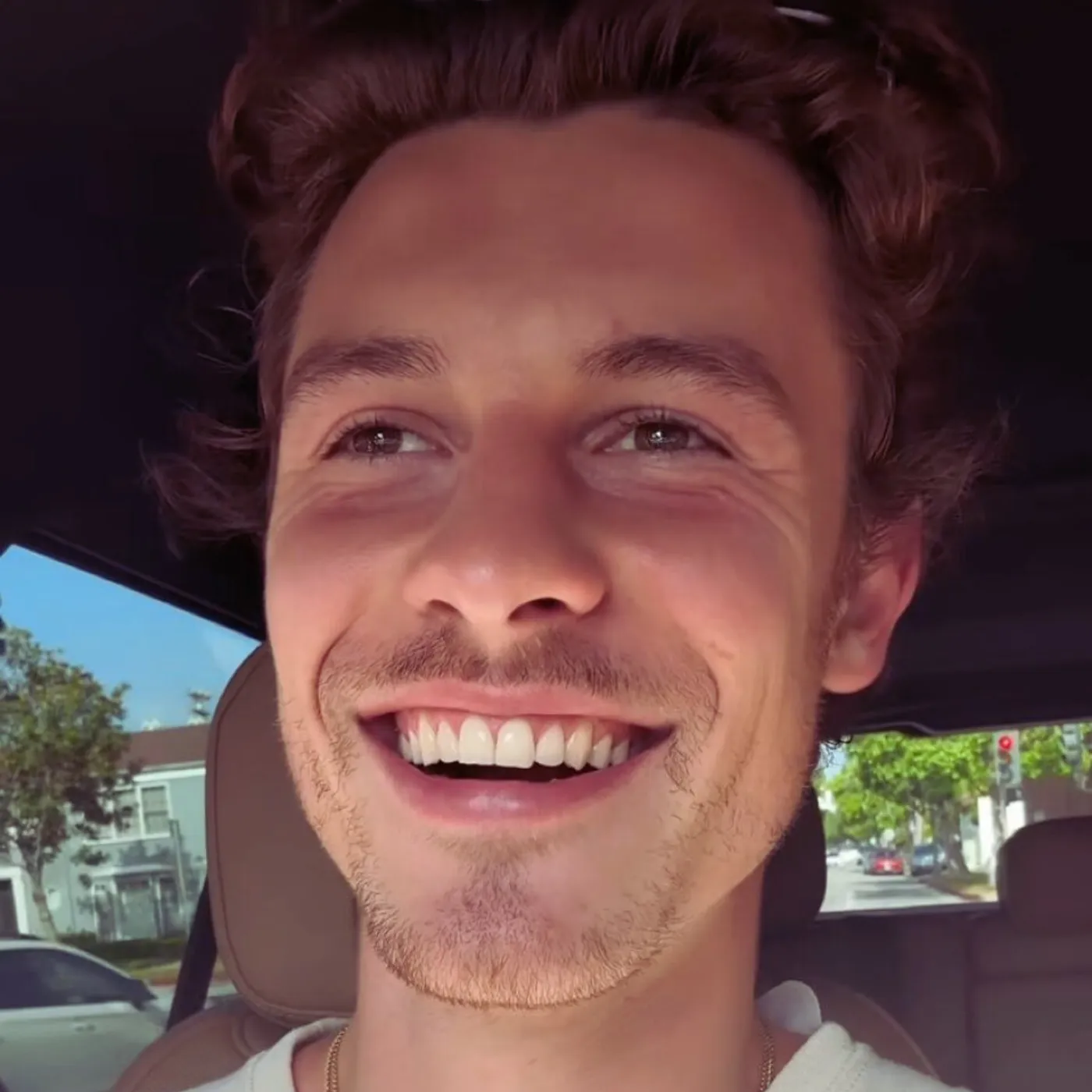 image_6840fc1661386 Shawn Mendes Unveils Stunning New Smile Transformation