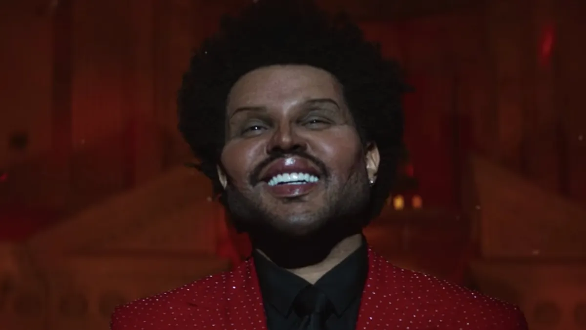 image_68424a2d1a1ab The Weeknd’s Complete Transformation? The Shocking Truth Behind His Surgical Appearance!