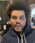 The Weeknd’s Complete Transformation? The Shocking Truth Behind His Surgical Appearance!