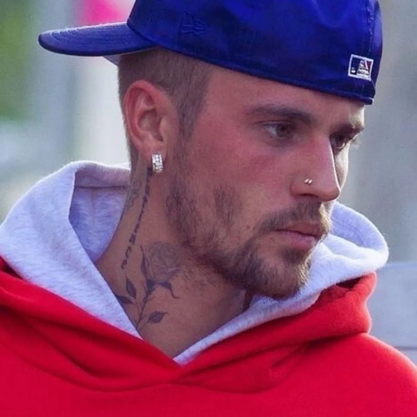 image_6843c4650e181 Inside Justin Bieber’s Troubling Turn: Mystery Injury, Erratic Behavior, and Hailey’s Deafening Silence
