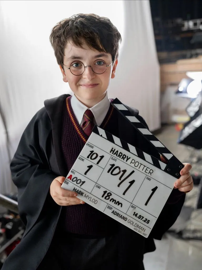 image_68775760c3b9e What unusual feature about Dominic McLaughlin helped him get cast as the lead actor for Harry Potter?