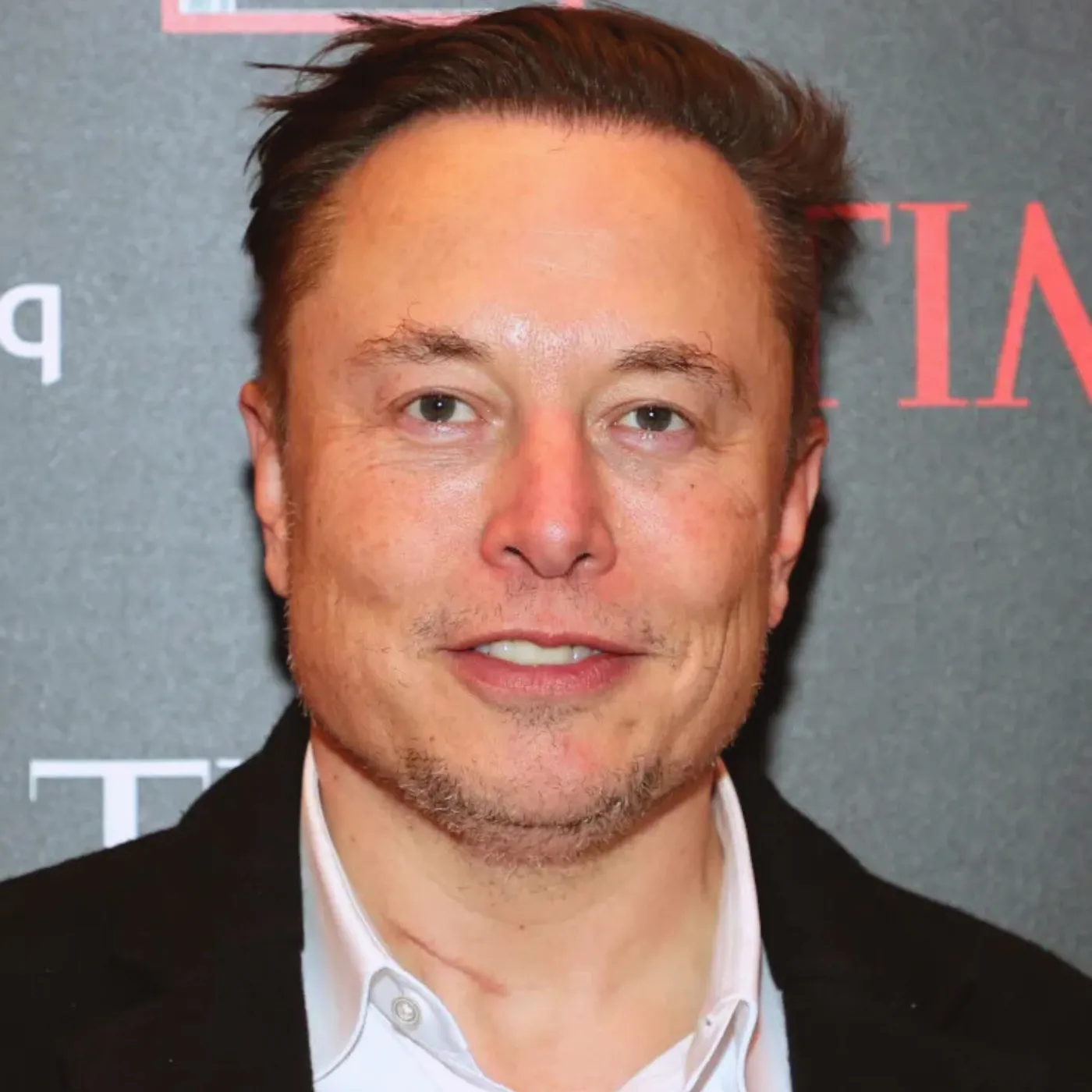 No One Noticed... Until They Zoomed in on Elon Musk’s Neck