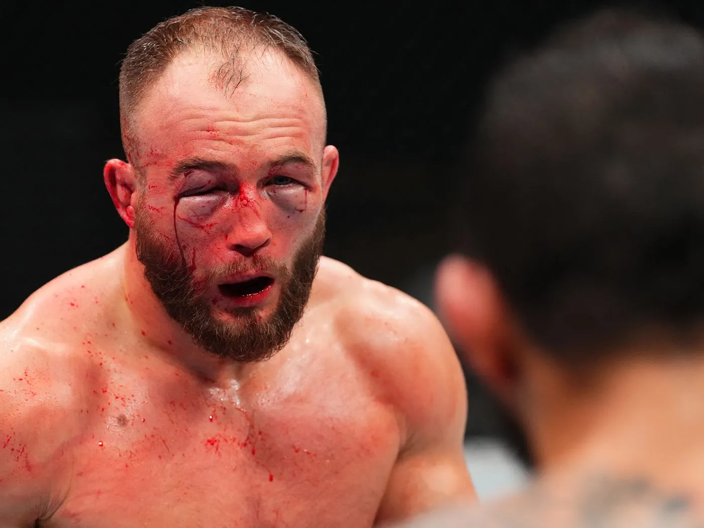 image_68903ccd75ae2 After the Bloodshed: What the Media and Fans Are Saying About Rebecki vs Duncan