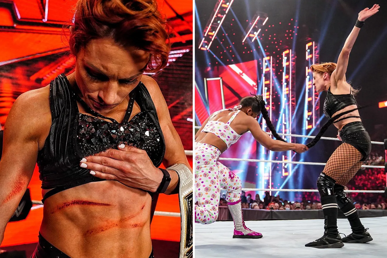 image_6892d051bb8b9 She Just Whipped Her Hair… and Her Opponent Needed Stitches! No One Expected Bianca Belair’s ‘CRACK’ to Be That Real!