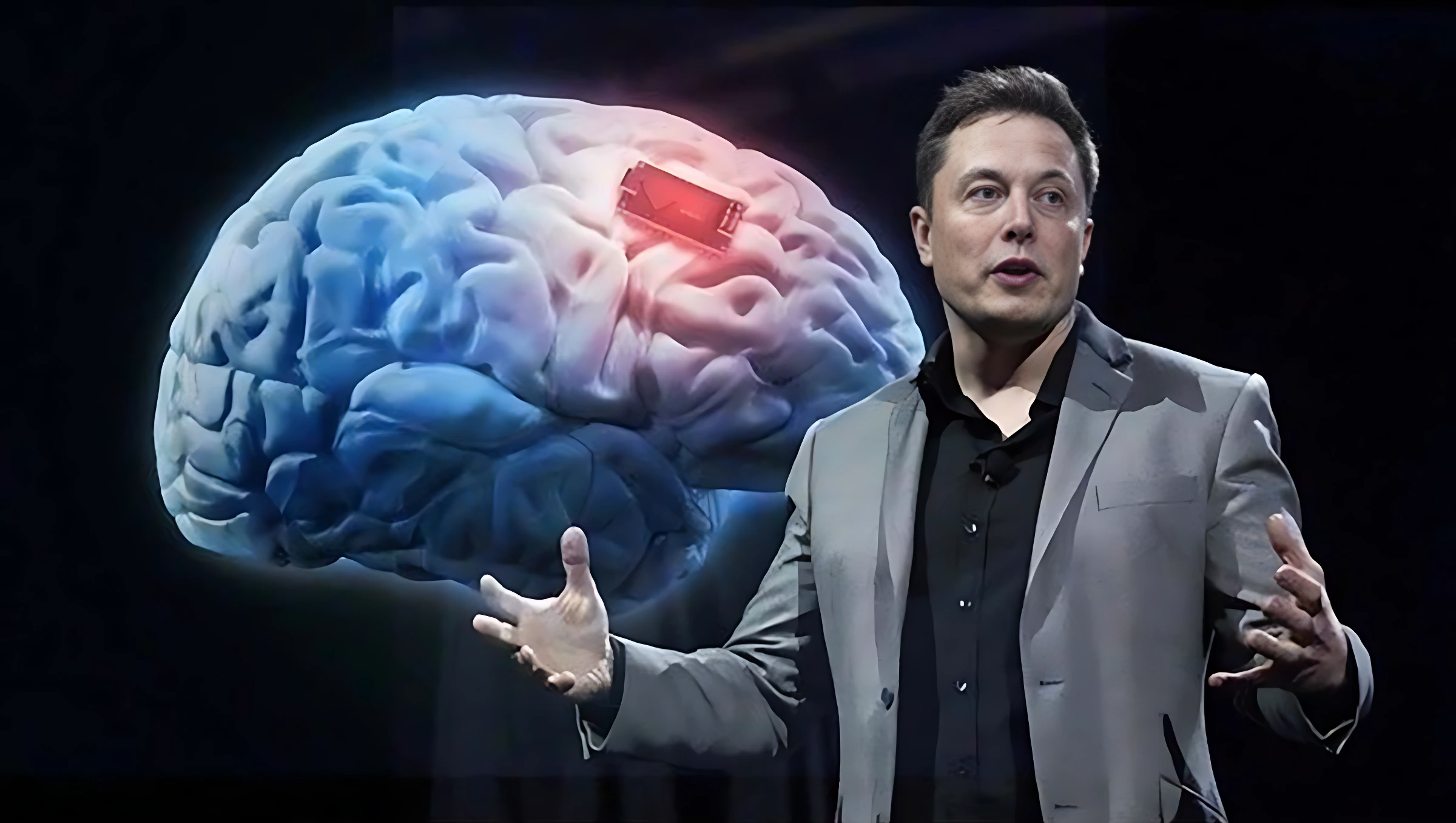 Life After Neuralink: How Is the First Patient With Elon Musk’s Brain Implant Doing?