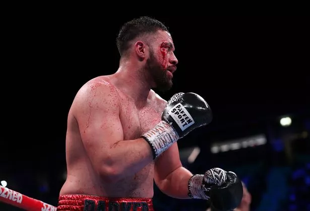 image_68b79a8136e5c Joseph Parker to Face a British Heavyweight in His Next Outing