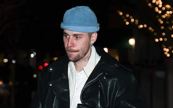 image_68bd44327d80e Is He Really Okay? Justin Bieber’s Health Becomes Hot Topic