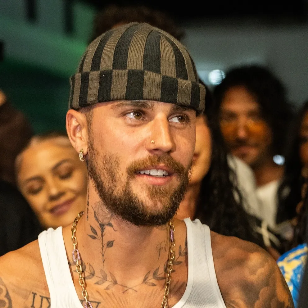 image_68bd4433320fe Is He Really Okay? Justin Bieber’s Health Becomes Hot Topic