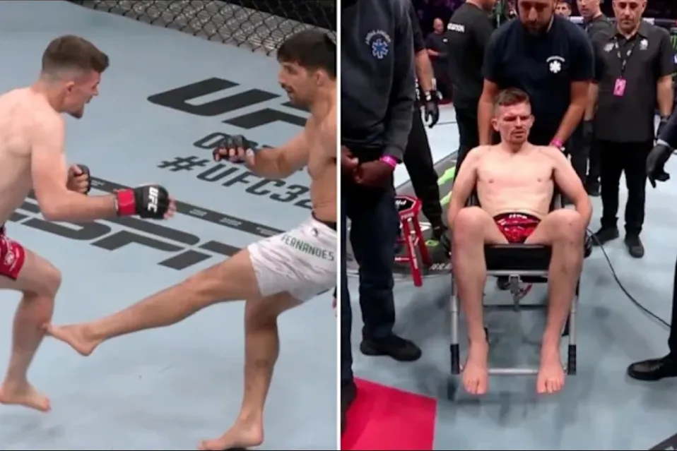 Harry Hardwick leaves UFC Paris with serious injury that may leave him unable to walk again - Painful lesson for every fighter